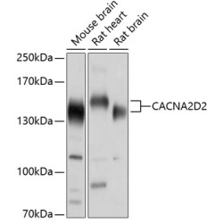 CACNA2D2 Rabbit pAb