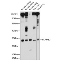 KCNMB2 Rabbit pAb