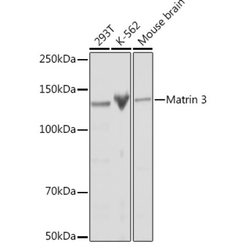 Matrin 3 Rabbit mAb