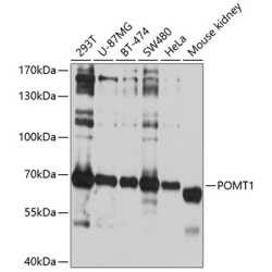 POMT1 Rabbit pAb