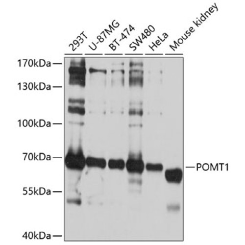 POMT1 Rabbit pAb