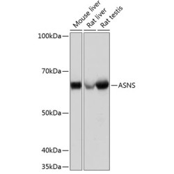 ASNS Rabbit mAb