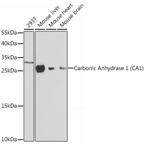Carbonic Anhydrase 1 (CA1) Rabbit pAb