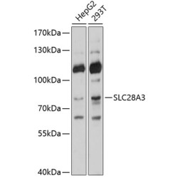 SLC28A3 Rabbit pAb