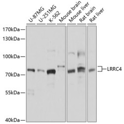 LRRC4 Rabbit pAb