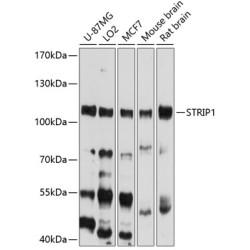 STRIP1 Rabbit pAb