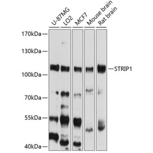STRIP1 Rabbit pAb