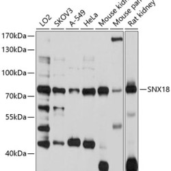 SNX18 Rabbit pAb