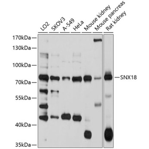 SNX18 Rabbit pAb