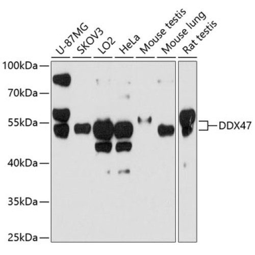 DDX47 Rabbit pAb