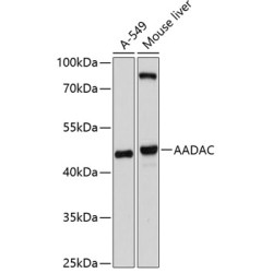 AADAC Rabbit pAb
