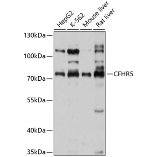 CFHR5 Rabbit pAb