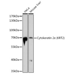 Cytokeratin 2e (KRT2) Rabbit pAb