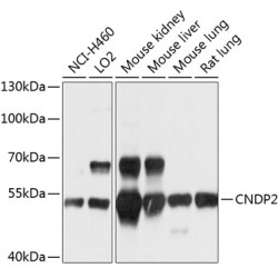 CNDP2 Rabbit pAb