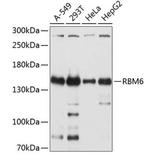 RBM6 Rabbit pAb