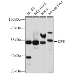 ZIP8 Rabbit pAb