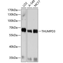 THUMPD3 Rabbit pAb
