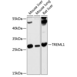 TREML1 Rabbit pAb