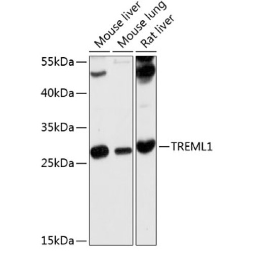 TREML1 Rabbit pAb