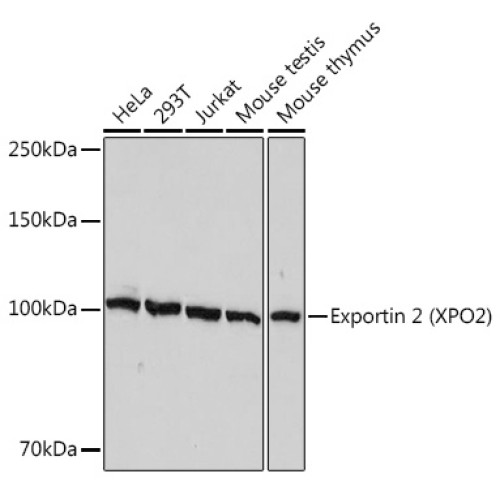 Exportin 2 (XPO2) Rabbit mAb