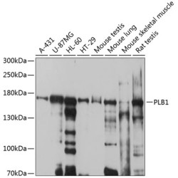 PLB1 Rabbit pAb