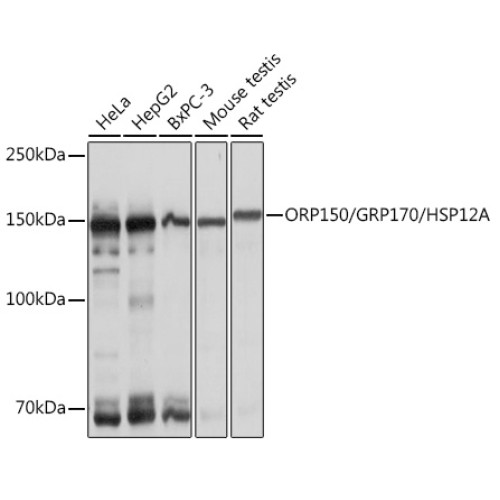 ORP150/GRP170/HSP12A Rabbit mAb