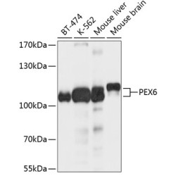 PEX6 Rabbit pAb