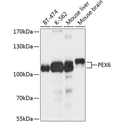 PEX6 Rabbit pAb