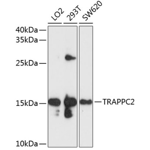 TRAPPC2 Rabbit pAb