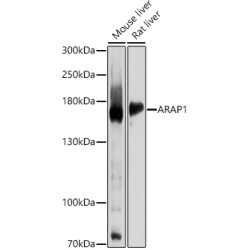 ARAP1 Rabbit pAb