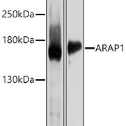 ARAP1 Rabbit pAb