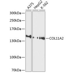 COL11A2 Rabbit pAb