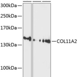 COL11A2 Rabbit pAb