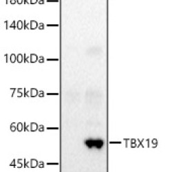 TBX19 Rabbit pAb