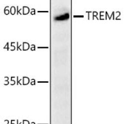 TREM2 Rabbit pAb
