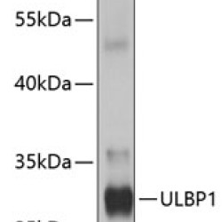 ULBP1 Rabbit pAb