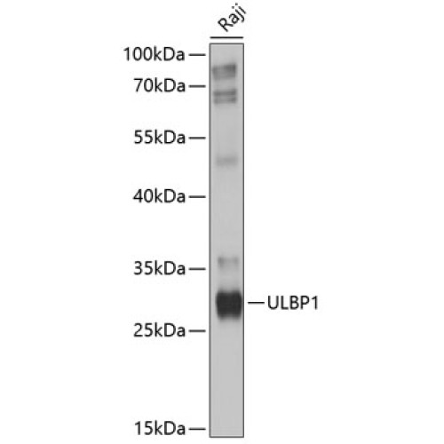 ULBP1 Rabbit pAb