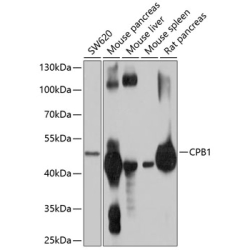 CPB1 Rabbit pAb