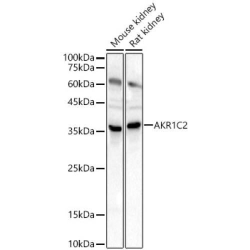 AKR1C2 Rabbit pAb