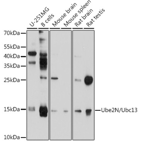 Ube2N/Ubc13 Rabbit pAb