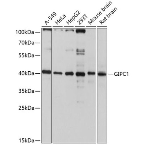 GIPC1 Rabbit pAb