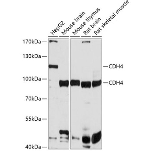 CDH4 Rabbit pAb