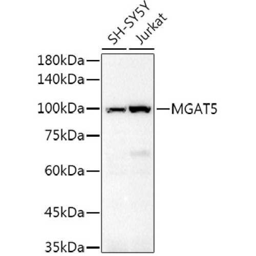 GNT-V/MGAT5 Rabbit pAb