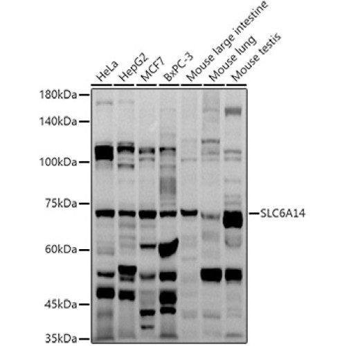 SLC6A14 Rabbit pAb