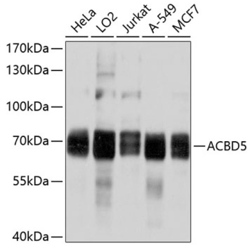 ACBD5 Rabbit pAb