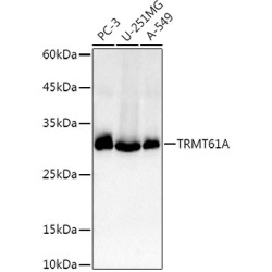 TRMT61A Rabbit pAb
