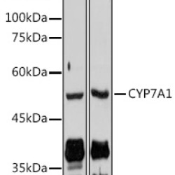 CYP7A1 Rabbit pAb