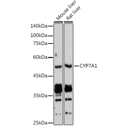 CYP7A1 Rabbit pAb