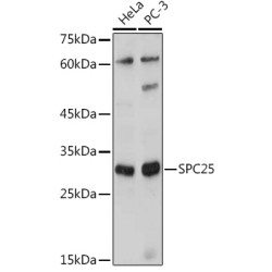 SPC25 Rabbit pAb