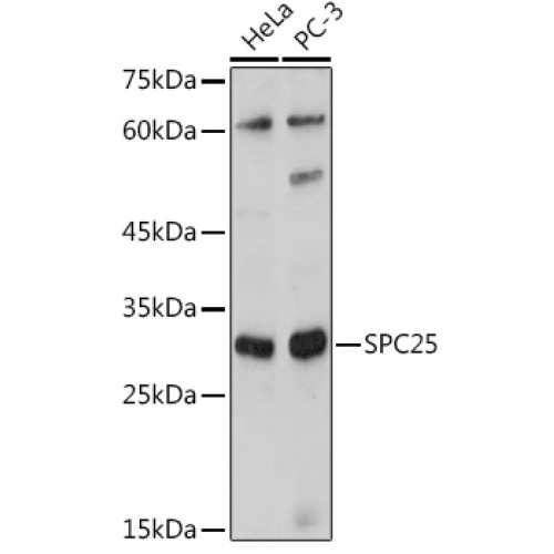 SPC25 Rabbit pAb